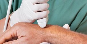 артрит як причини болю в суглобах пальців рук